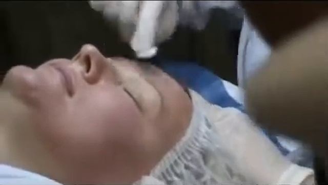 Семинар по использованию Мезороллера wmv смотреть онлайн