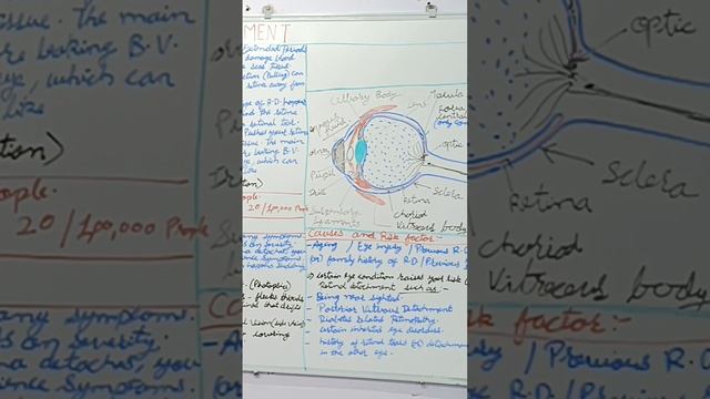 Retinal Detachment #retina #retinaldetachment #hindi # #biology # #science #eye #rinkeshpariyani смотреть онлайн