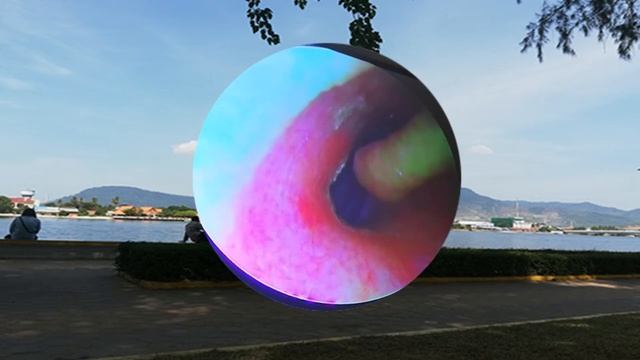 Ear Wax Removal Eps#229 || чистка ушной серы #229 смотреть онлайн