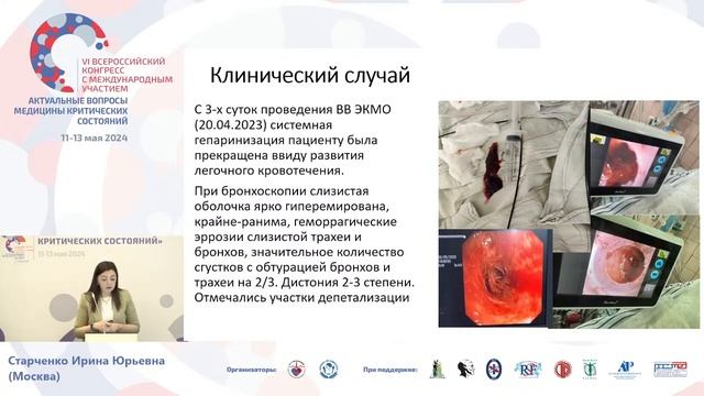 ЭКМО при лечении боевой травмы Старченко И.Ю. смотреть онлайн