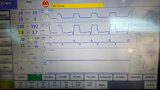 Скрытые фазовые пространства в электрофизиологии смотреть онлайн