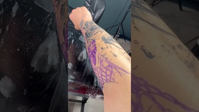 Татуированная болезнь