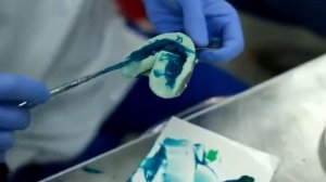 Снятие слепков под коронки в стоматологии «Все свои!»