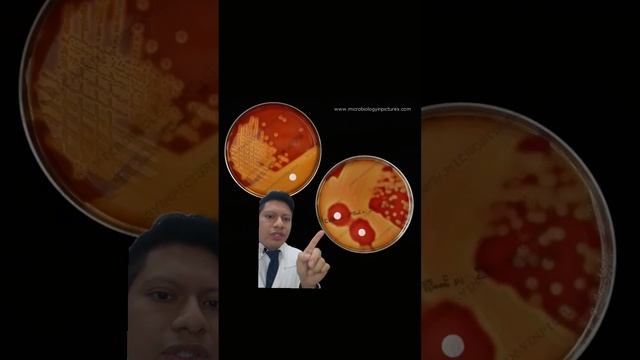 Así se identifican los estreptococos del grupo A (prueba de bacitracina) смотреть онлайн