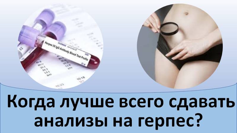 Когда лучше сдавать анализы на герпес смотреть онлайн