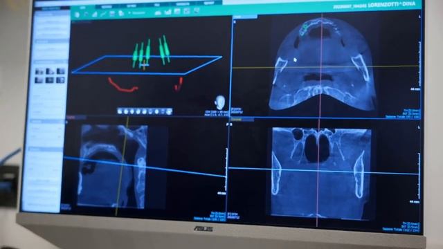 Video Presentazione dello Studio Dentistico Pisano e Procchio Alessandria AL смотреть онлайн