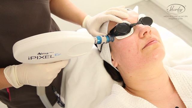 Leczenie blizn i przebarwień potrądzikowych, laser Alma Harmony XL PRO смотреть онлайн