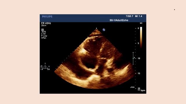 EZECHO 2018 - Day 1, Session 7 смотреть онлайн