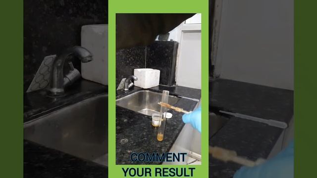 Urine Protein test|Albumin|Sulphosalicylic Acid test |#short смотреть онлайн