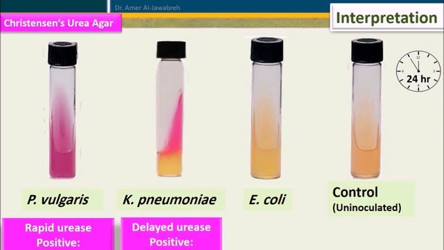 Urease Test смотреть онлайн