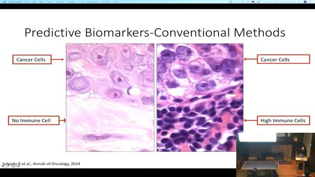 Elahe Shenasa | Using the Body's Own Immune System Against Tumours: Could Immunotherapy Cure Cancer смотреть онлайн