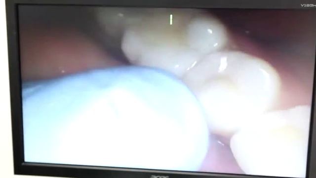 Стоматология «Все Свои» в Алтуфьево