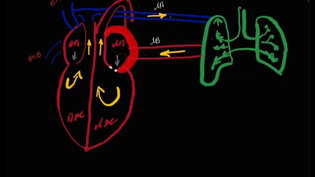 Митральный стеноз (mitral stenosis) بالعربي смотреть онлайн