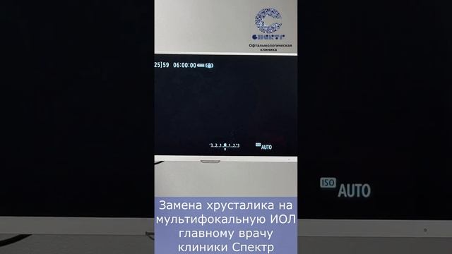 Замена ИОЛ при пресбиопии врачу-офтальмологу. #доктор #офтальмология смотреть онлайн