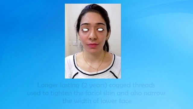 Best Beauty Treatments India| Juvederm fillers injections Mumbai, India - Dr. Debraj Shome смотреть онлайн