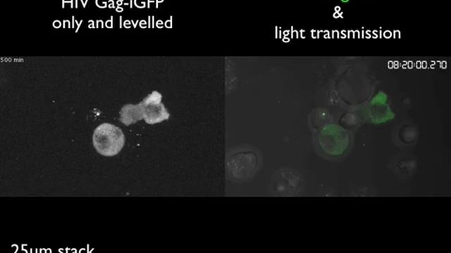 HIV Virus Infection Of CD4+ T Cells By Means Of Jurkat Cells
