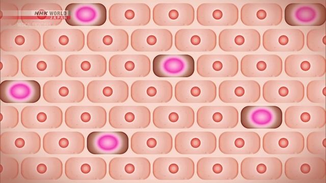 Breakthroughs in Stopping Aging - Medical Frontiers смотреть онлайн