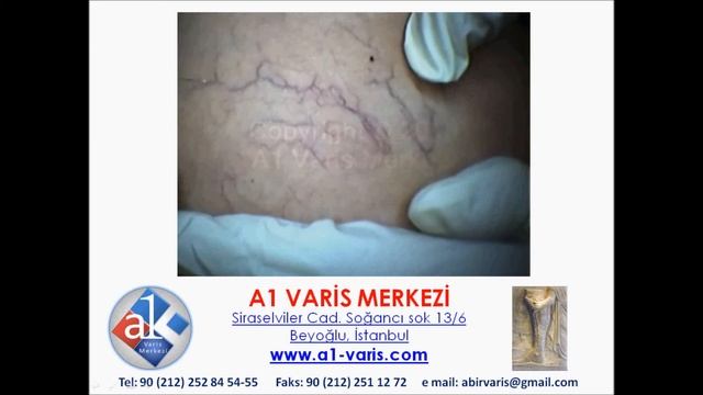 A1 VARİS MERKEZİ смотреть онлайн