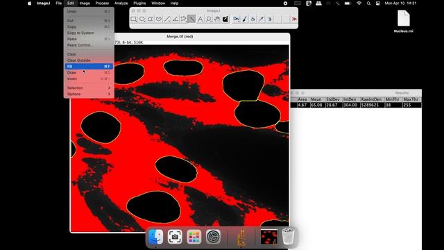 How to measure the staining INTENSITY of NUCLEUS and CYTOPLASM using ImageJ Software смотреть онлайн