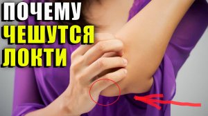 Почему чешутся локти
