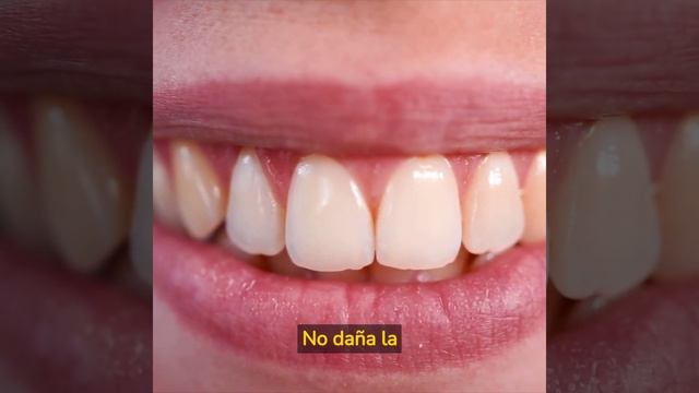 GEL DENTAL PRO ACTIVE смотреть онлайн