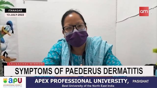 Symptoms of Paederus Dermatitis. смотреть онлайн