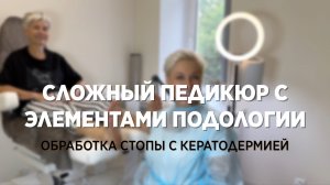 Сложный педикюр. Работа с элементами Подологии. Обработка сложной стопы с кератодермией.