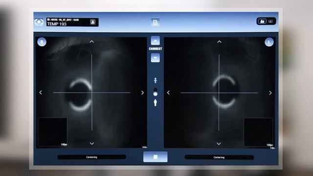 Eye Refract - Dynamic Refraction System смотреть онлайн