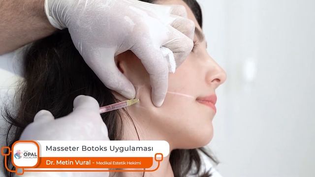 Masseter Botoks Uygulaması I Dr. Metin Vural