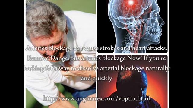 CoQ10 Health Benefits смотреть онлайн