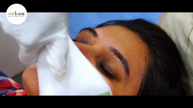 How I treated my Dark Circle | Arginine Peel | Chemical Peel | Skincare | Urban Skin Hair Clinic смотреть онлайн