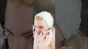 Ставлю ботокс (botulax) сама себе