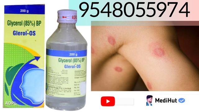 Glerol OS Syrup| Glycerol 85%BP | Glerol OS Syrup Benefits | Glycerol 85%Uses in Hindi | Glycerol O смотреть онлайн