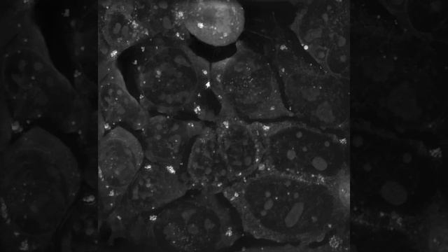 STEM CELLS: Long Term Live Imaging of Mouse Embryonic Stem Cells for 9,5 hours! Part 1 смотреть онлайн