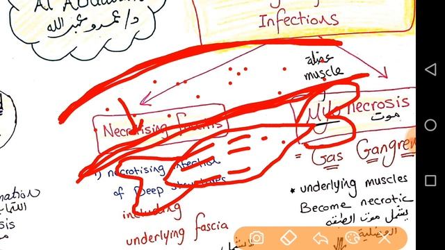 Introduction to Musculoskeletal Module Microbiology | Dr Amr Abdallah смотреть онлайн