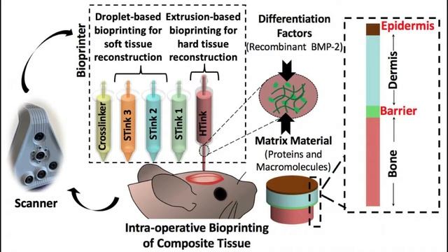 Skin and bones repaired by bioprinting during surgery смотреть онлайн