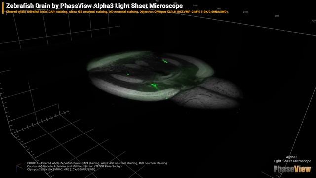 Zebrafish Brain by PhaseView Alpha3 Light Sheet Microscope смотреть онлайн