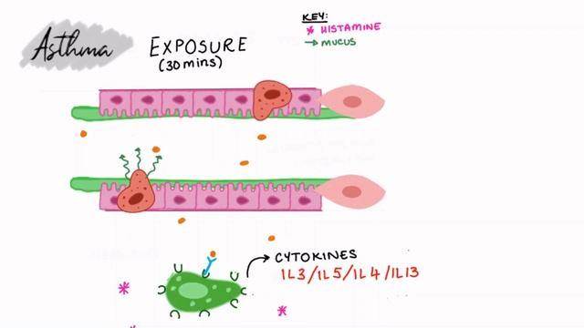 Overview of Asthma| MedStudier смотреть онлайн