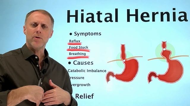 Understanding a Hiatal Hernia смотреть онлайн