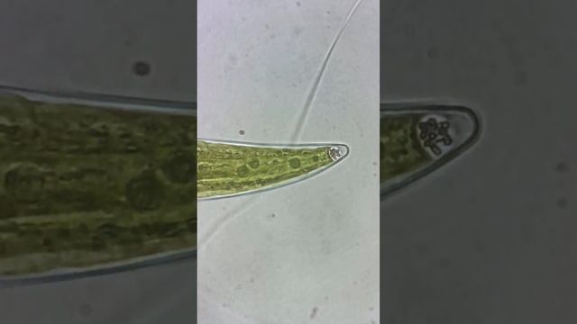 Barium sulphate crystals in a desmid смотреть онлайн