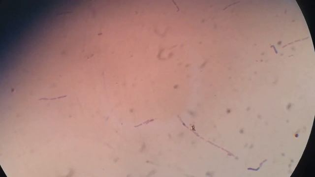 Bacillus on chocolate agar and its motility under the microscope смотреть онлайн