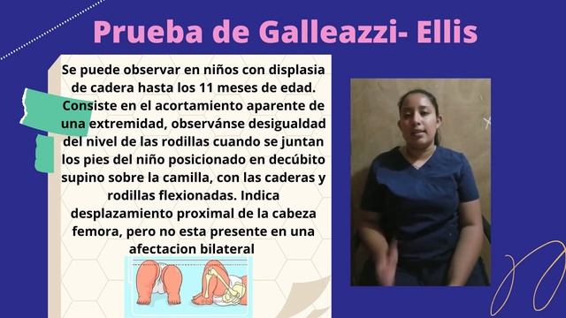 Maniobra de Weber-Barstow/Prueba de Galleazzi-Ellis. Ortopedia смотреть онлайн