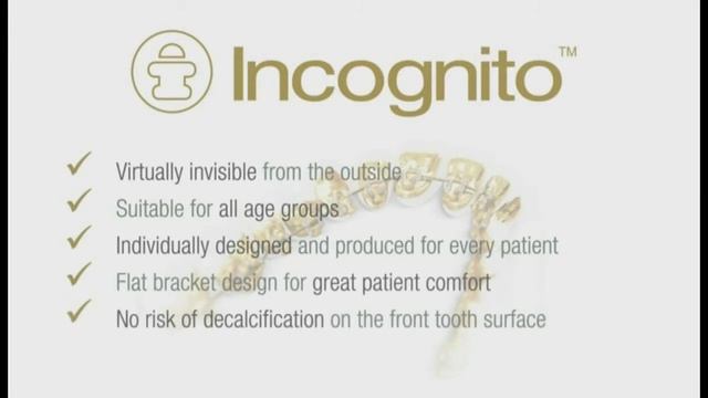 Apie nematomus vidinius breketus „Incognito" смотреть онлайн