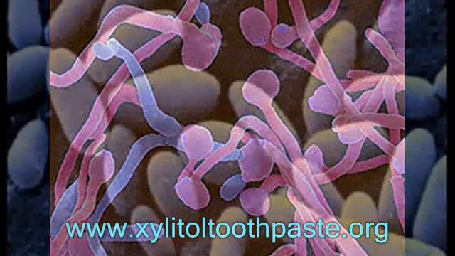 Xylitol Benefits смотреть онлайн