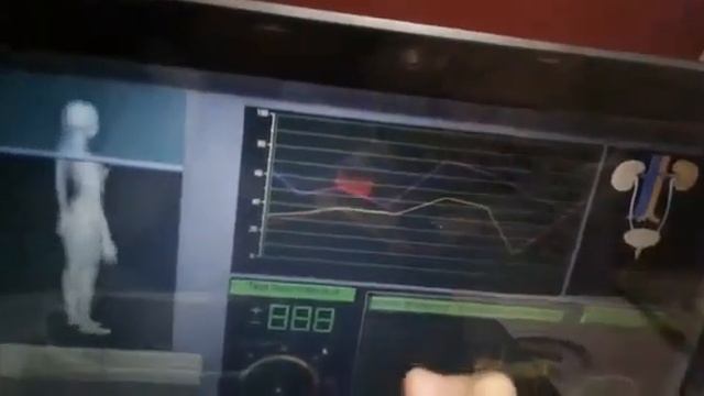 How to use Quantum Therapy Analyzer Machine смотреть онлайн