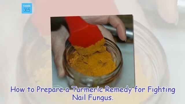 Fight Nail Fungus With This Natural Turmeric Remedy - Canada 365 смотреть онлайн