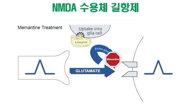 치매 : 치매약에 관하여 смотреть онлайн