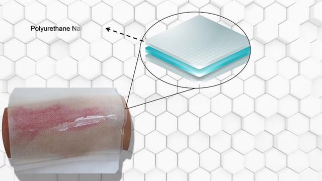 Nanofiber/Hydrogel Multilayer 3D Burn Cover | WINTEX смотреть онлайн