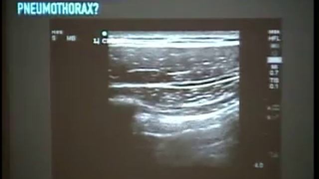 Radiology 3-3-16 смотреть онлайн