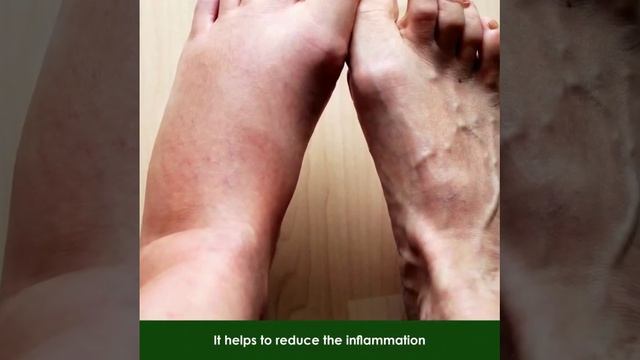 Qurist CBD+THC Oil | CBD Store India смотреть онлайн